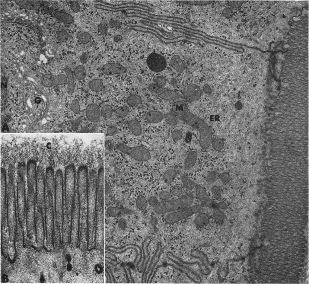 FIGURE 3 Electron micrograph of villous absorptive cells from a normal biopsy cultured in vitro for 24 hr. A.
