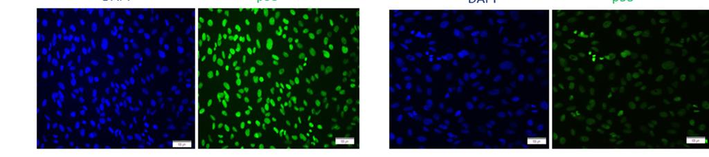 Ad-MSCs cultured on fd-ecm for 2 days; (C) Immunofluorescence analysis of p53 expression in Ad-MSCs cultured on control plastic dishes for 2 days; and (D)