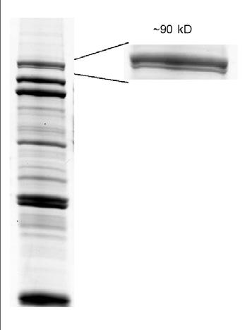 When an identical sample was run on both Mini-PROTEAN and Laemmli system gels, the protein bands on the Mini-PROTEAN gel were consistently about the same width as the loading well, whereas band