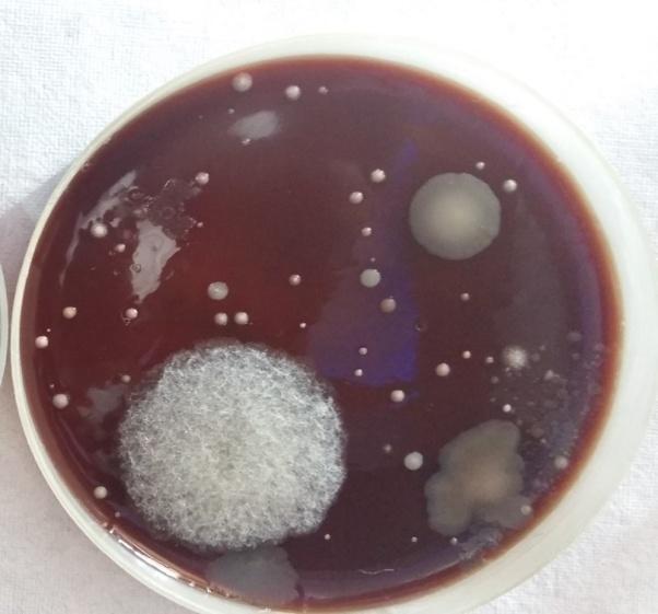57% samples had colonies of staphylococcus aureus, 7% samples