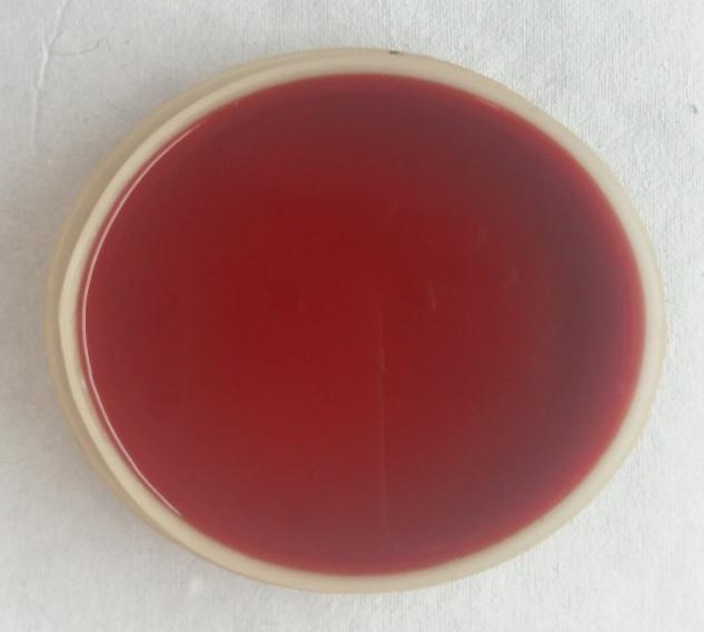 colonies of Aspergillus niger and 29% samples had significant