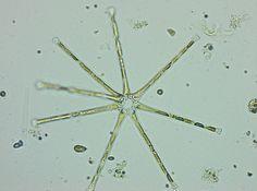 Question 3: What do changes in epilimnion thickness mean for phytoplankton in Acadia lakes?