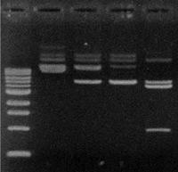 Plasmid Restriction Mapping 2 Gel electrophoresis is used to separate restriction fragments according to size.
