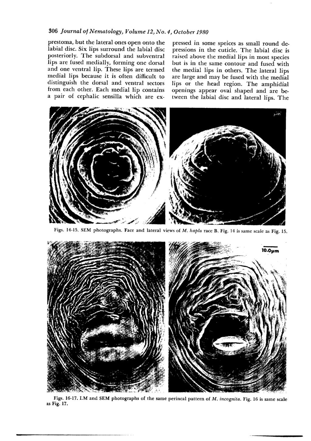 306 Journal o] Nematology, Volume 12, No. 4, October 1980 prestoma, but the lateral ones open onto the labial disc. Six lips surround the labial disc posteriorly.