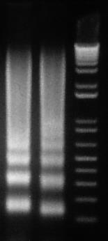 incubation step should be skipped, as high level DNase can digest DNA ladder generating a smear pattern.) 6.