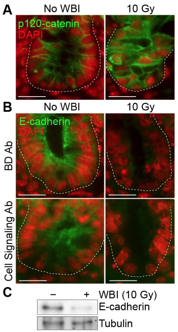 Supplementary Figure 7. Change in cell adhesion components by radiation (A) Localization change of p120-catenin by radiation. Mice were treated with WBI (10 Gy).