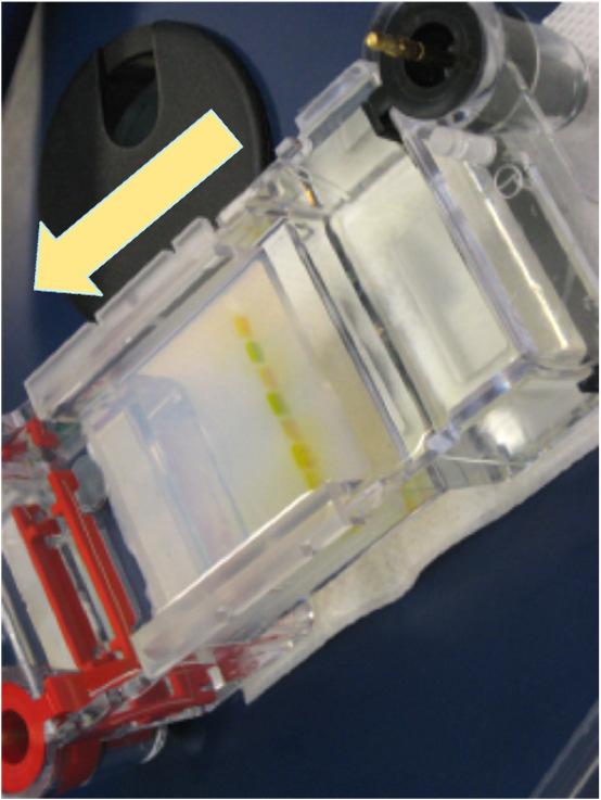 Gel Electrophoresis + - DNA has a negative charge electricity forces DNA through the gel towards the cathode (positive terminal) Pieces