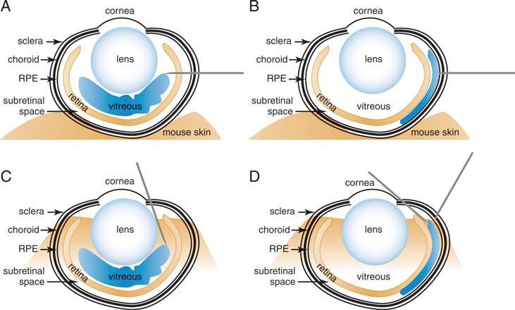 Retinal Gene Delivery by raav and DNA Electroporation, Aditya Venkatesh et all, Current Protocols in Microbiology, 14D.4.1-14D.4.32, February 2013 FIGURE 1.