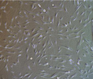 Mesenchymal stem cell (MSC) An undifferentiated cell that s held in reserve until replacement or