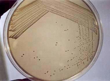 the plate; each sweep of the loop should be in a new or virgin area of the agar. Continue until you have streaked about 1 4 of the agar surface. 7. Sterilize/cool the loop. 8.
