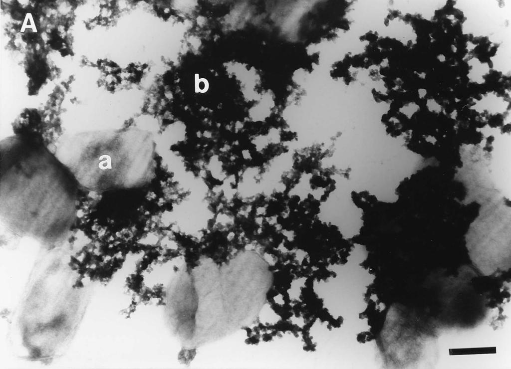 1216 RIPP AND MILLER APPL. ENVIRON. MICROBIOL. FIG. 2. Electron micrographs depicting aggregate formation.