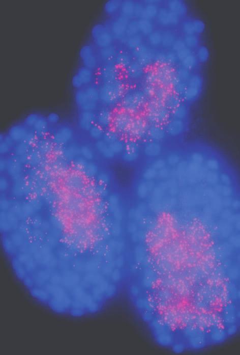 Counting the hundreds of dots in three different colors in individual embryos allows the researchers to reconstruct the dynamics of gene expression in single cells.