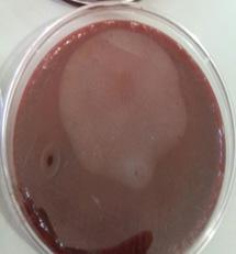 nutrient agar and blood agar which is more