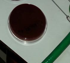 agar which is more rich for bacteria growth.