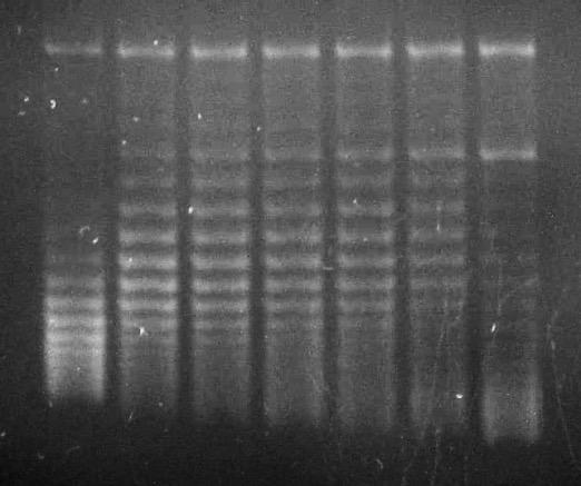 The DNA topoisomers were isolated and subjected to agarose gel electrophoresis in the absence of chloroquine.