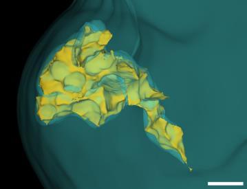To quantify those 3D tumor data, a novel set of custom-developed image analysis algorithms were developed