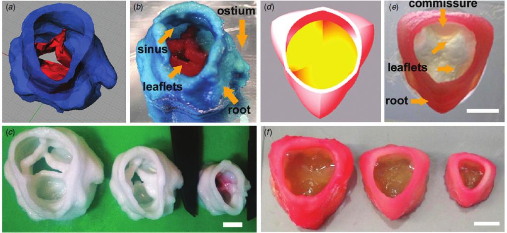 Application of Hydrogels in Heart Valve Tissue Engineering 121 FIG. 7T: Printing heterogeneous valve and scaled valve constructs.
