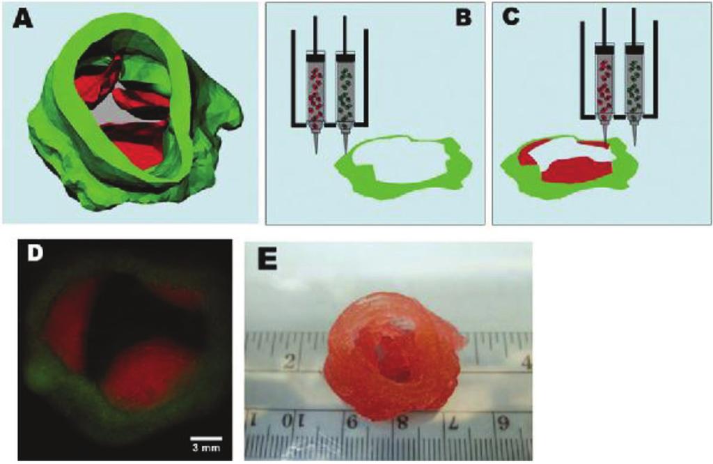 Application of Hydrogels in Heart Valve Tissue Engineering 123 FIG. 9T: Bioprinting of aortic valve conduit. (A) Aortic valve model reconstructed from micro-ct images.