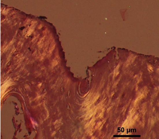 Next to the carbonization line, a small tissue layer, about 10-20 µm thick, shows a small layer of darker staining (Fig. 6, left panel). This is the layer, for which thermal damage could be detected.