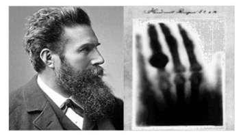 Radiograph of the hand of Albert von Kolliker, Roentgen went on to win the first Nobel Prize in 1901 for his invention Biomedical engineering integrates physical, chemical, mathematical and