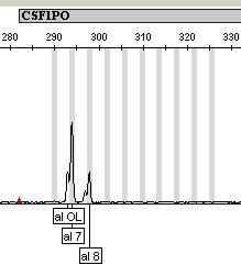 Incomplete 3 (+A) nucleotide addition Can be a result of too much DNA amplified in the PCR