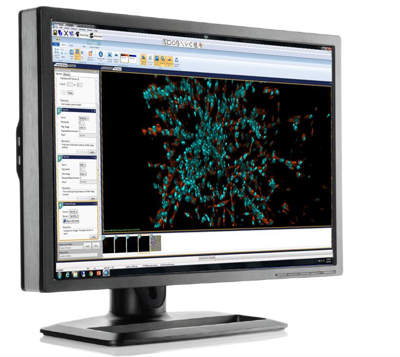 sub-cellular and multi-parametric responses in diverse biological systems Capture high-resolution images, recognize and segment objects, calculate parameters, and then translate your information into