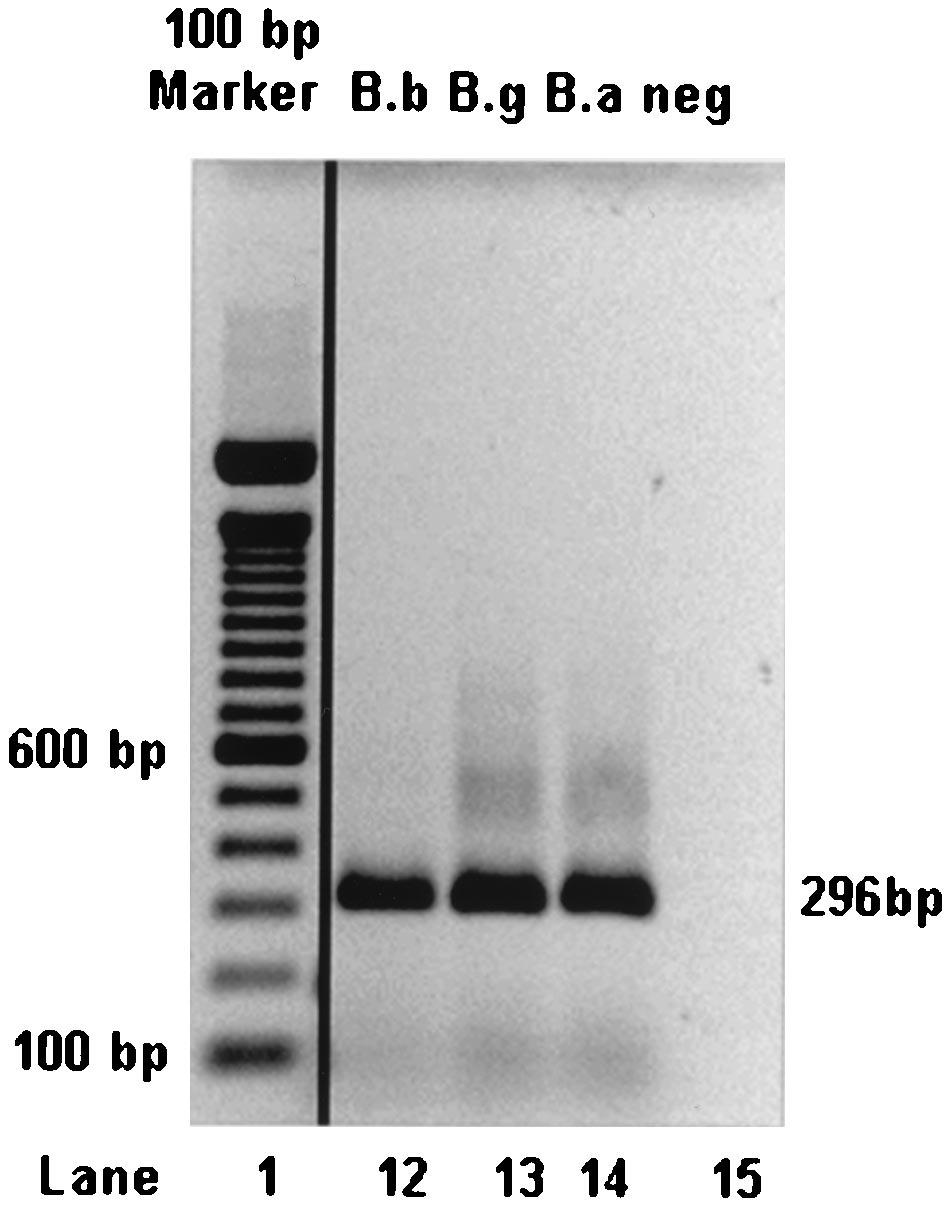 VOL. 40, 2002 BORRELIA STRAIN DIFFERENTIATION BY PCR 39 FIG. 3. Gel electrophoresis of PCR products from three B. burgdorferi sensu lato strains.
