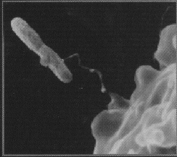 Alternatives for controlling opportunistic pathogens Four of the opportunists that are often mentioned are: Legionella pneumophila Mycobacterium avium complex Aeromonas hydrophila Pseudomonas