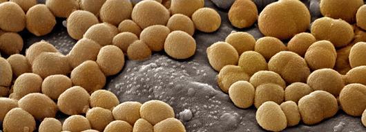 Bacteria Cell Shapes The basic shape of