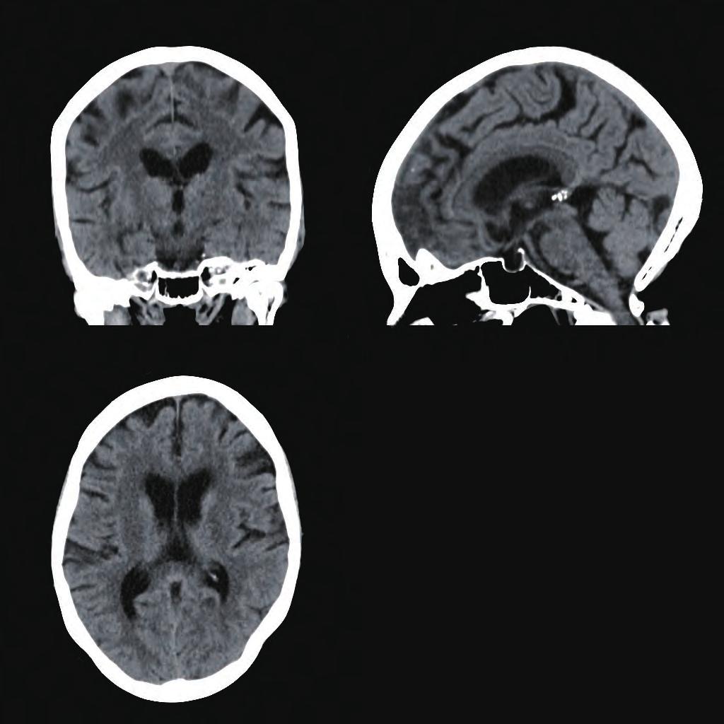 Brain Imaging Superb brain image quality with clear grey-white matter