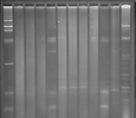 A Webber Training Teleclass April 8, 24 Plasmid Profiling PCR based Typing One of the oldest genotypic methods (separating plasmids on gels) Not all clinically significant bacteria have detectable