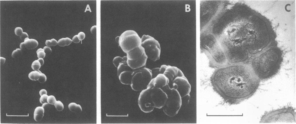 130 GUTMANN AND TOMASZ ANTIMICROB. AGENTS CHEMOTHER. z I-I 0 C, HOURS FIG. 1. Inhibition of growth of wild-type and penicillin-resistant streptococci by penicillin.