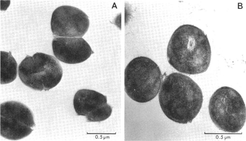 <.. -- - - - - -C VOL. 22, 1982 PENICILLIN-RESISTANT GROUP A STREPTOCOCCI 133 B 0.5pm 0.5 pm FIG. 5. Morphology of penicillin-treated and control group A streptococci.