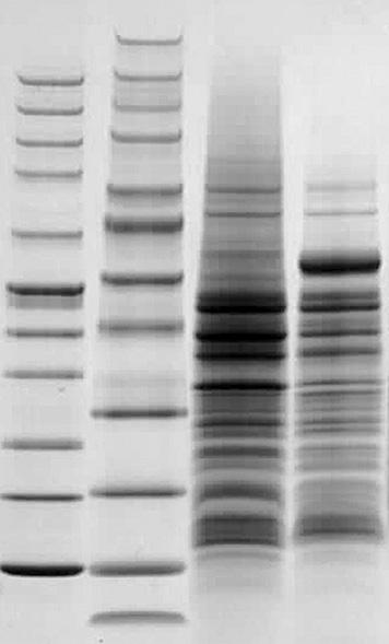 BioResearch ProSieve EX Running and Western Blot Transfer Buffers Simple, sharp and fast New protein separation and Western blot transfer buffers are