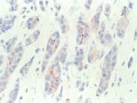 CLSI guidelines for IHC Single Tonsil,