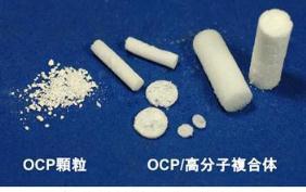 Bone regeneration by OCP materials OCP granules OCP-polymer