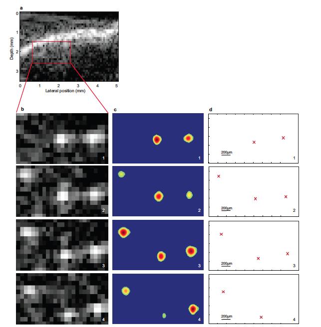 The principle of ultrafast ultrasound localization microscopy a, Average stack of 250 beamformed images