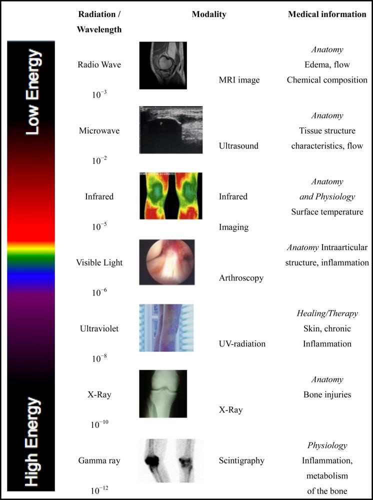 In vivo imaging : main modalities Electromagnetic radiation: Partical