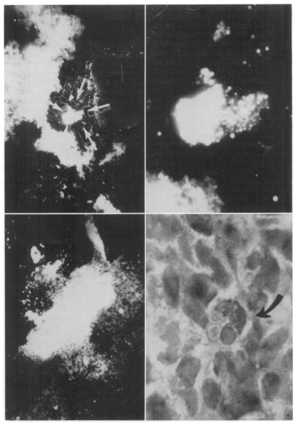 Figure 1 was prepared from the fetus of a rabbit that was infected 13 days after breeding, and Figure 2 is a higlier magnification of the portion indicated by arroius in