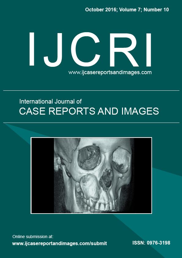 www.edoriumjournals.com CLINICAL IMAGES PEER REVIEWED OPEN ACCESS Severe Stargardt disease with peripapillary sparing Heather Leisy, Meleha Ahmad, Nathaniel Tracer, R.