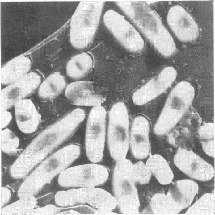 Some pictures suggest that these may represent a first, and only, step to- Figure 2. Bacteria incubated for 12 minutes in fresh medium after receiving the same dose of X- rays (16, r).