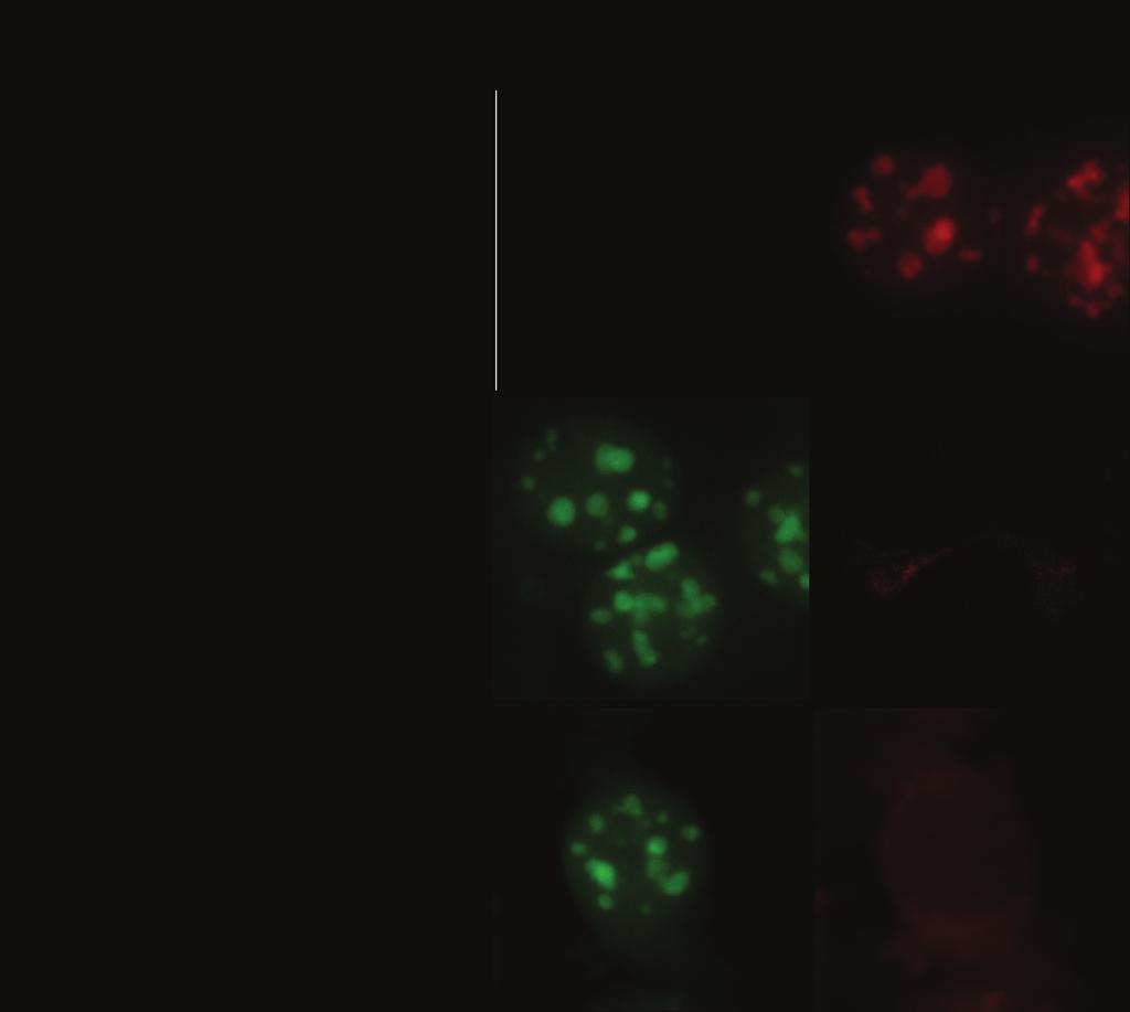 (a) (b) (c) Supplementary Figure S3. Absence of green and red channel interference for single staining of MeCP2 cells with anti-mecp2 polyclonal antibody or GFP 1-10 reagent.