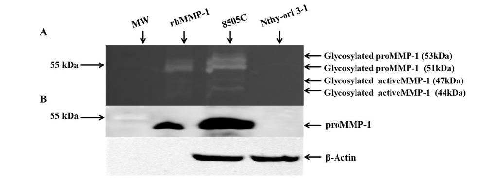 REPORTS A B Figure 3. MMP-1 activity and expression levels in human thyroid cell lines.