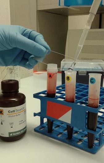 Add 1 ml of CellSearch Dilution buffer to the HD blood tube as well.