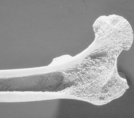 Macrostructure Bone: a Natural Composite Material - The microstructure of bone is complex, containing many constituents in both the micro- and the nanorange