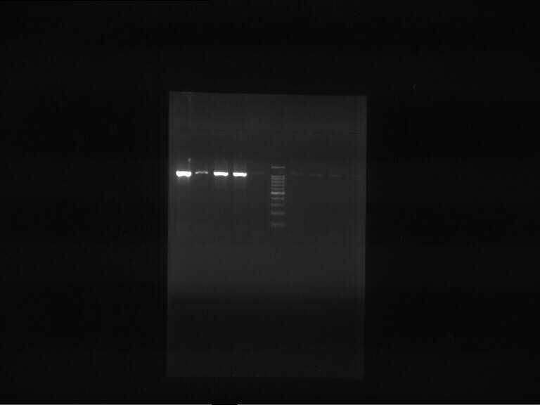 Figure 3: PCR of 5 samples ; Visible bands with 1080 bp size were seen in positive samples in comparison with DNA Ladder Figure 4: PCR of 8 samples; Visible bands with 1080 bp size were seen in