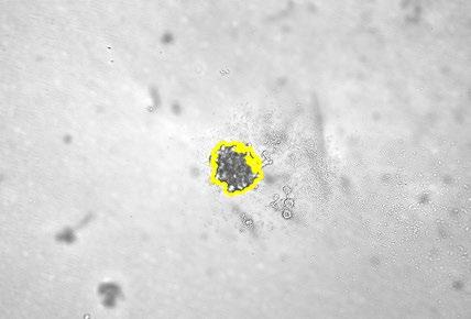 MDA-MB-231, HT-1080 and A549 cells in a spheroid assay.