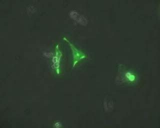 Recognise damaged cells Cells detach. Blebs form.