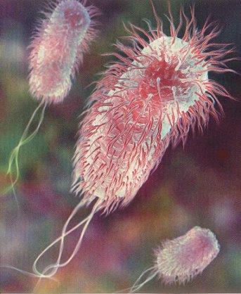 E coli E coli- is one example of a bacteria that is anaerobic Anaerbic bacteria cannot live