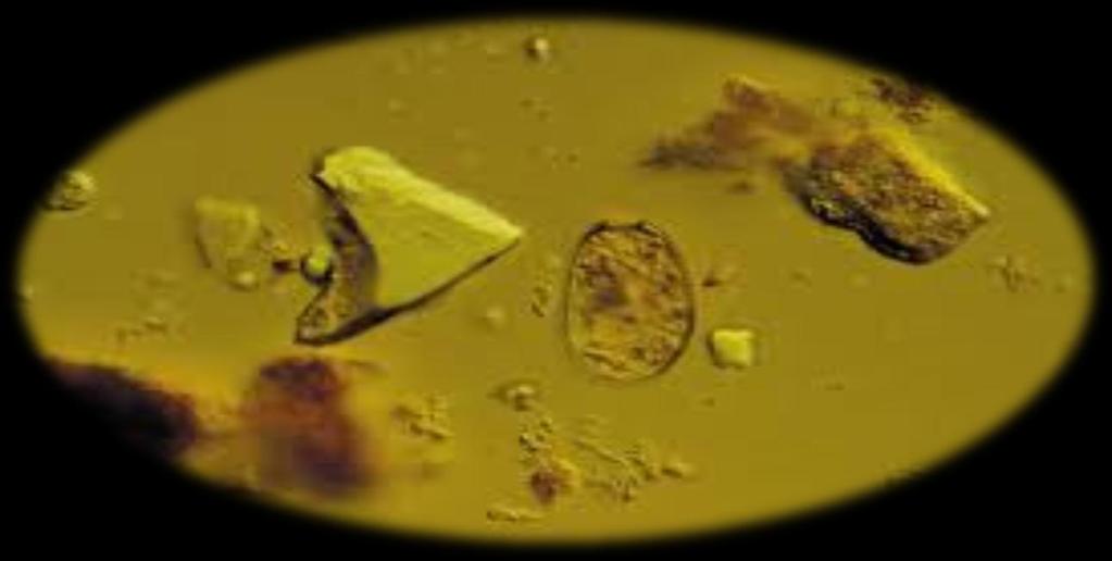 Protozoa The oval protozoa grazes on the smaller specks of bacteria The